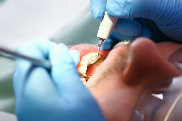 Best Emergency Tooth Extraction  in Ridgeway, VA